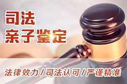 温州司法DNA鉴定去哪里做